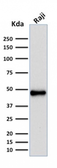 Anti-PAX5 antibody [rPAX5/2060] used in Western Blot (WB). GTX02690