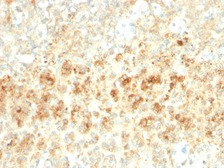 Anti-ADFP antibody [ADFP/2755R] used in IHC (Paraffin sections) (IHC-P). GTX02691