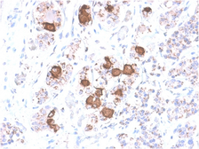 Anti-ACTH antibody [CLIP/2040R] used in IHC (Paraffin sections) (IHC-P). GTX02692