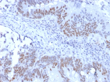 Anti-Rb antibody [RB1/2313R] used in IHC (Paraffin sections) (IHC-P). GTX02700