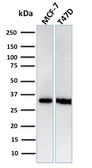 Anti-RPA32 antibody [RPA2/3140R] used in Western Blot (WB). GTX02702