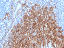 Anti-Syndecan-1 / CD138 antibody [SDC1/4378R] used in IHC (Paraffin sections) (IHC-P). GTX02707