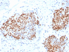 Anti-SOX9 antibody [SOX9/3916R] used in IHC (Paraffin sections) (IHC-P). GTX02712