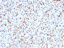 Anti-SOX9 antibody [SOX9/3141R] used in IHC (Paraffin sections) (IHC-P). GTX02713