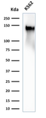 Anti-CD43 antibody [SPN/2049R] used in Western Blot (WB). GTX02714