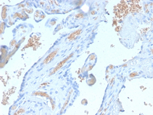Anti-alpha 1 Spectrin antibody [SPTA1/2939R] used in IHC (Paraffin sections) (IHC-P). GTX02715