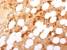 Anti-CD71 antibody [TFRC/2898R] used in IHC (Paraffin sections) (IHC-P). GTX02719