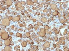 Anti-Thyroglobulin antibody [TGB/1968R] used in IHC (Paraffin sections) (IHC-P). GTX02721