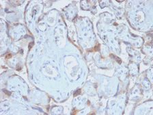 Anti-TIMP2 antibody [TIMP2/2488R] used in IHC (Paraffin sections) (IHC-P). GTX02722
