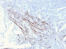 Anti-Tenascin C antibody [rTNC/3635] used in IHC (Paraffin sections) (IHC-P). GTX02724