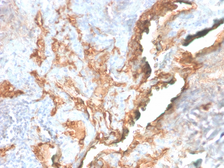 Anti-Tenascin C antibody [TNC/2981R] used in IHC (Paraffin sections) (IHC-P). GTX02725