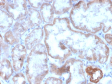 Anti-CD137 antibody [r4-1BB/4603] used in IHC (Paraffin sections) (IHC-P). GTX02726