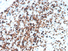 Anti-Topoisomerase II alpha antibody [TOP2A/4397R] used in IHC (Paraffin sections) (IHC-P). GTX02727