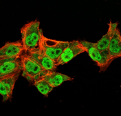 Anti-p63 antibody [TP40/3980R] used in Immunocytochemistry/ Immunofluorescence (ICC/IF). GTX02728