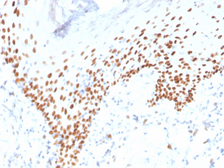 Anti-p63 antibody [rTP40/3690] used in IHC (Paraffin sections) (IHC-P). GTX02729