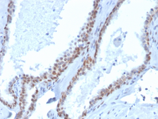 Anti-p63 antibody [rTP40/3690] (Biotin) used in IHC (Paraffin sections) (IHC-P). GTX02730