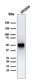 Anti-Thymidine Phosphorylase antibody [rTYMP/3444] used in Western Blot (WB). GTX02733