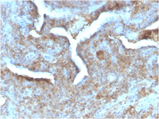 Anti-Thymidine Phosphorylase antibody [TYMP/2890R] used in IHC (Paraffin sections) (IHC-P). GTX02734