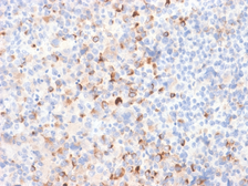 Anti-Tyrosinase antibody [TYR/2024R] used in IHC (Paraffin sections) (IHC-P). GTX02735