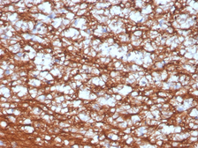 Anti-PGP9.5 antibody [UCHL1/4556R] used in IHC (Paraffin sections) (IHC-P). GTX02737