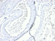 Anti-Villin antibody [VIL1/4107R] used in IHC (Paraffin sections) (IHC-P). GTX02739
