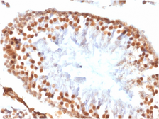 Anti-Wilms Tumor 1 antibody [WT1/1434R] used in IHC (Paraffin sections) (IHC-P). GTX02743