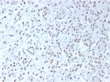 Anti-Wilms Tumor 1 antibody [WT1/1434R] used in IHC (Paraffin sections) (IHC-P). GTX02743
