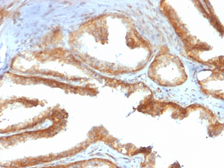 Anti-YB1 antibody [rYBX1/2430] used in IHC (Paraffin sections) (IHC-P). GTX02744