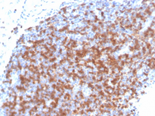 Anti-ZAP70 antibody [ZAP70/4040R] used in IHC (Paraffin sections) (IHC-P). GTX02746