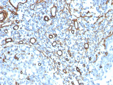 Anti-Collagen IV antibody [COL4/4241R] used in IHC (Paraffin sections) (IHC-P). GTX02748