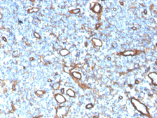 Anti-Collagen IV antibody [COL4/4241R] used in IHC (Paraffin sections) (IHC-P). GTX02748
