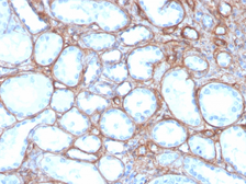 Anti-Collagen IV antibody [rCOL4/4742] used in IHC (Paraffin sections) (IHC-P). GTX02749