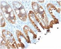 Anti-Cytokeratin 8 + 18 antibody [rKRT8.18/1346] used in IHC (Paraffin sections) (IHC-P). GTX02750