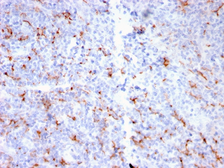 Anti-S100A8 + S100A9 antibody [MAC3157R] used in IHC (Paraffin sections) (IHC-P). GTX02753