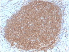 Anti-CD45RB antibody [PTPRC/2877R] used in IHC (Paraffin sections) (IHC-P). GTX02760