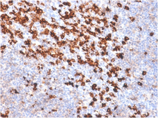Anti-Biotin antibody [BTN/2032R] used in IHC (Paraffin sections) (IHC-P). GTX02761