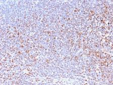 Anti-Nuclear Antigen antibody [NM2984R] used in IHC (Paraffin sections) (IHC-P). GTX02768