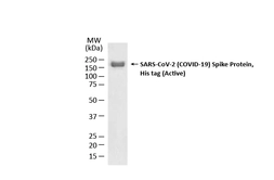 SARS-CoV-2 (COVID-19) Spike (ECD) Protein, His tag (active). GTX02774-pro