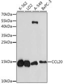 Anti-MIP3 alpha antibody used in Western Blot (WB). GTX02775