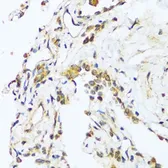 Anti-BAG3 antibody used in IHC (Paraffin sections) (IHC-P). GTX02777