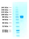 Human FGFR1 alpha IIIc (extracellular region) protein, His tag. GTX02782-pro