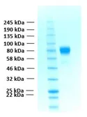Human FGFR1 alpha IIIc (extracellular region) protein, His tag. GTX02782-pro