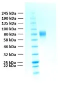 Human FGFR2 alpha IIIb (extracellular region) protein, His tag. GTX02783-pro