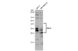 Anti-HAI-2 antibody [DC16] used in Western Blot (WB). GTX02800