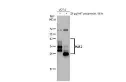 Anti-HAI-2 antibody [XY9] used in Western Blot (WB). GTX02801