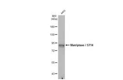 Anti-Matriptase / ST14 antibody [M24] used in Western Blot (WB). GTX02803