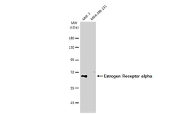 Anti-Estrogen Receptor alpha antibody [SC1] used in Western Blot (WB). GTX02805
