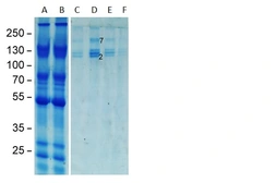 Anti-C3 antibody [M68] used in Immunoprecipitation (IP). GTX02807