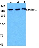 Anti-Fibulin 2 antibody used in Western Blot (WB). GTX02813
