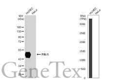 Anti-PAI-1 antibody [GT1223] used in Western Blot (WB). GTX02817